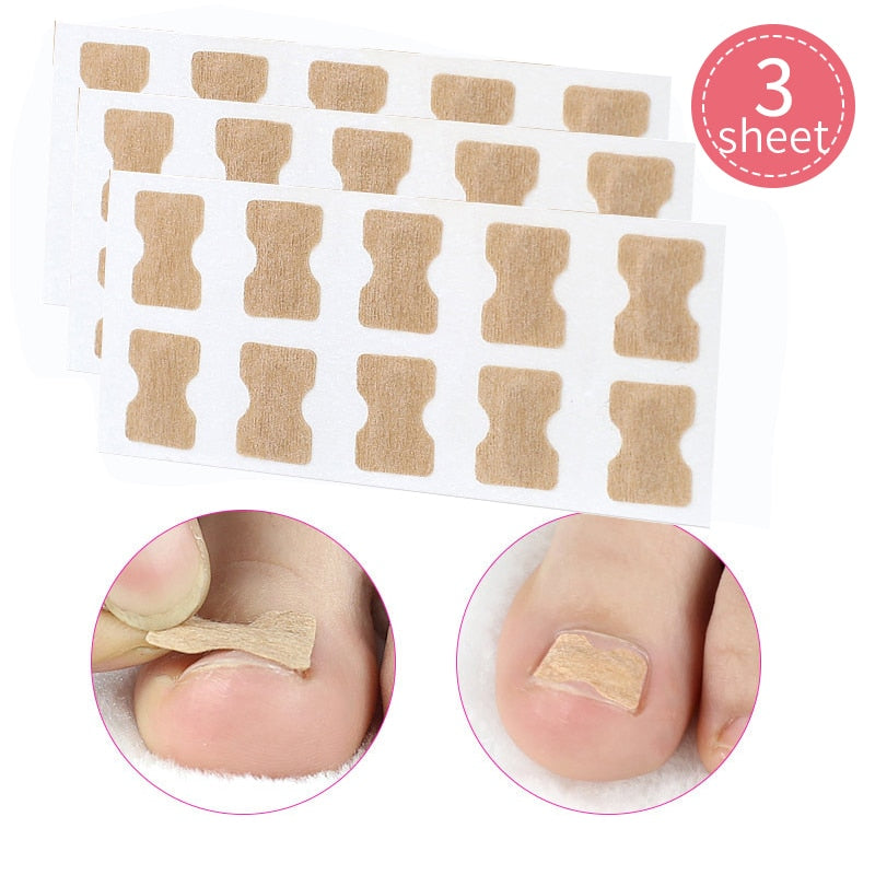 Toe Align Ingrown Nail Corrector Stickers