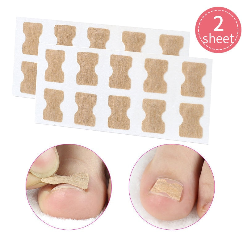 Toe Align Ingrown Nail Corrector Stickers