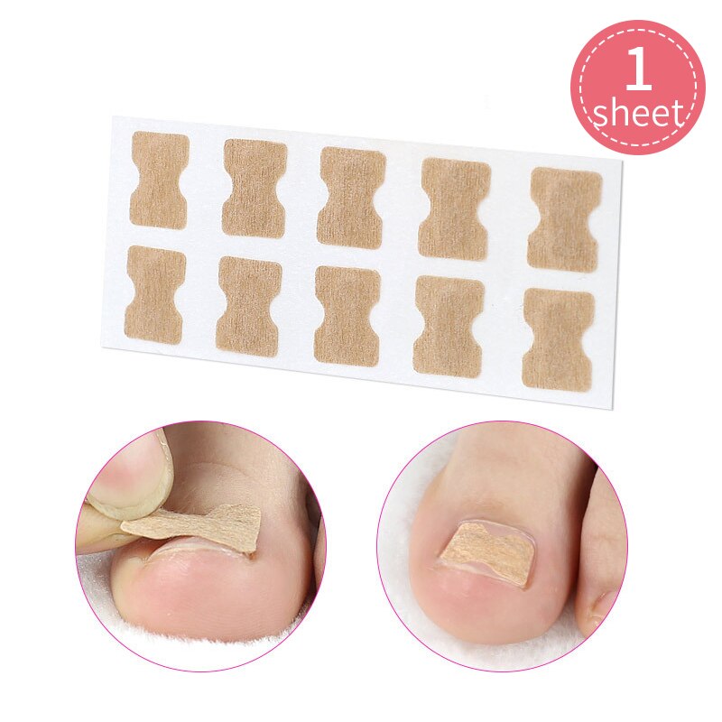 Toe Align Ingrown Nail Corrector Stickers